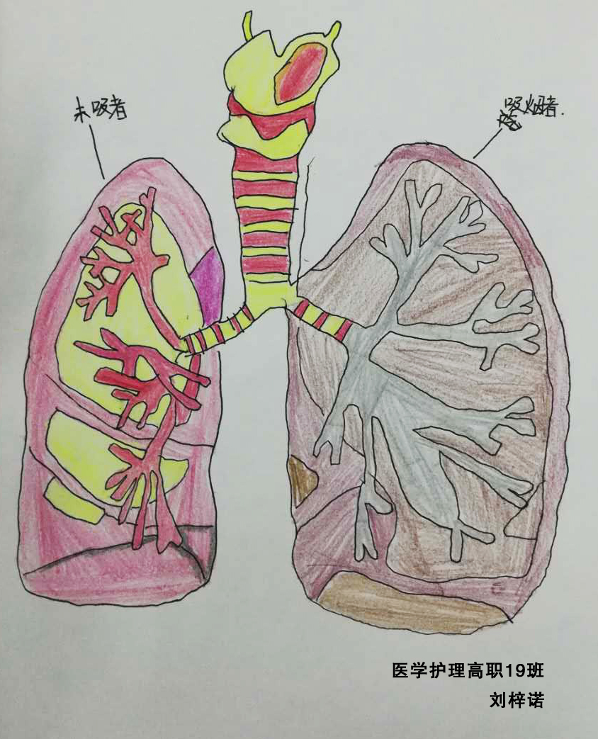 卫生健康学院举办"世界无烟日——吸烟前后肺部解剖对比图"绘画比赛